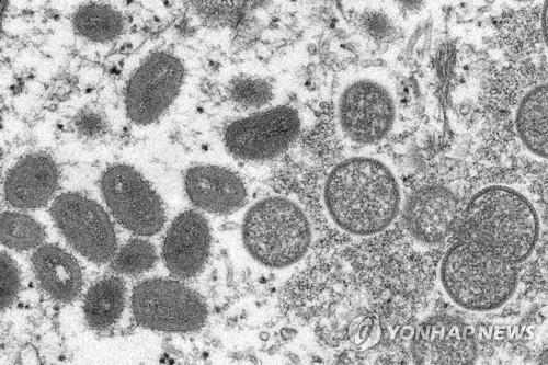 브라질, 원숭이두창 전국 확산세…확진 21명·의심 23명